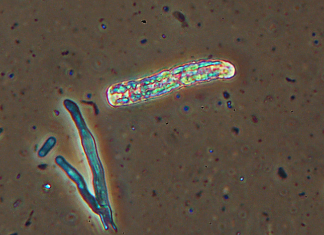 Lignicolo da determinare (Irpex lacteus)